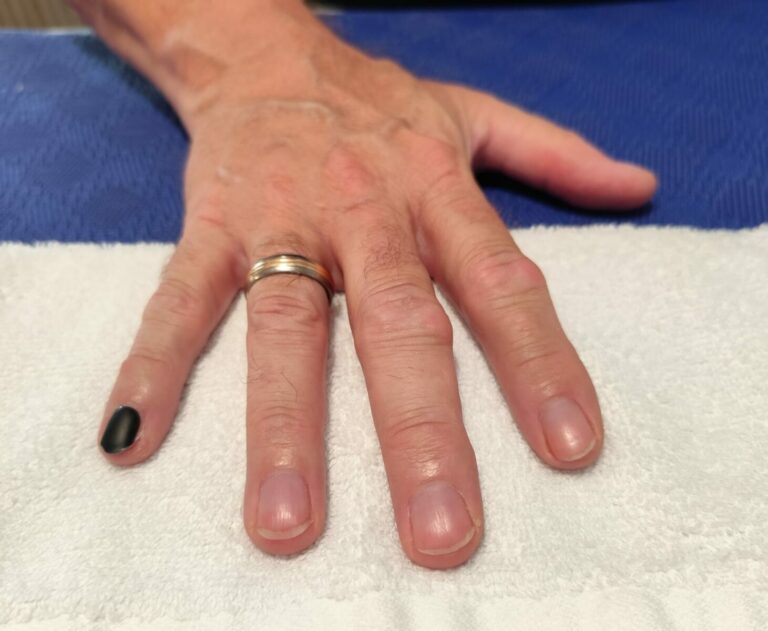 ein lackierter fingernagel